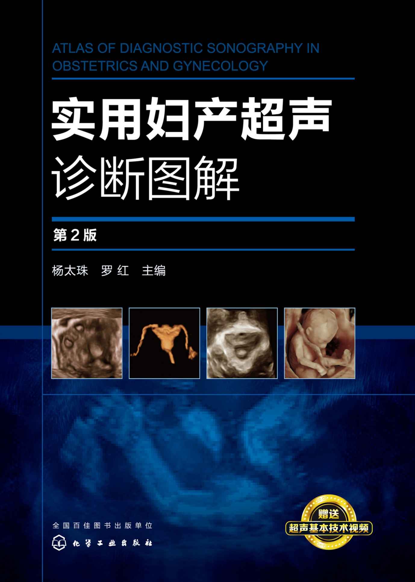 实用妇产超声诊断图解（第2版）