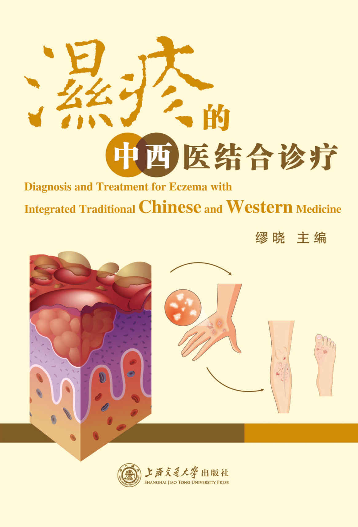 湿疹的中西医结合诊疗（上海市科委中医重点项目）