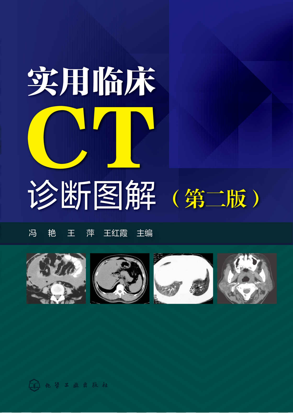 实用临床CT诊断图解（第二版）