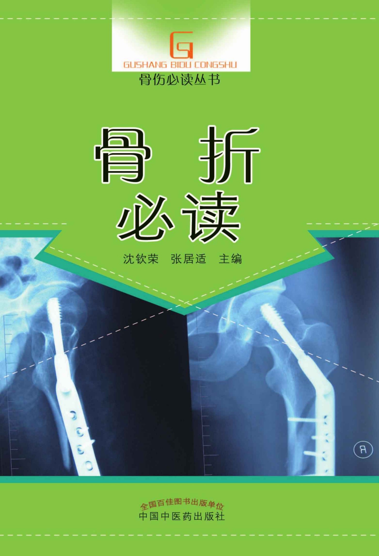 骨折必读 (骨伤必读丛书)